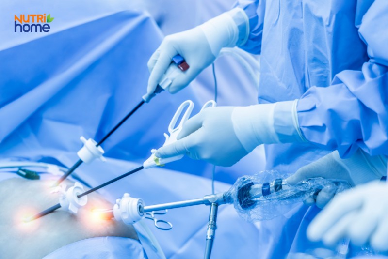 Phẫu thuật nội soi cắt túi mật điều trị viêm túi mật cấp