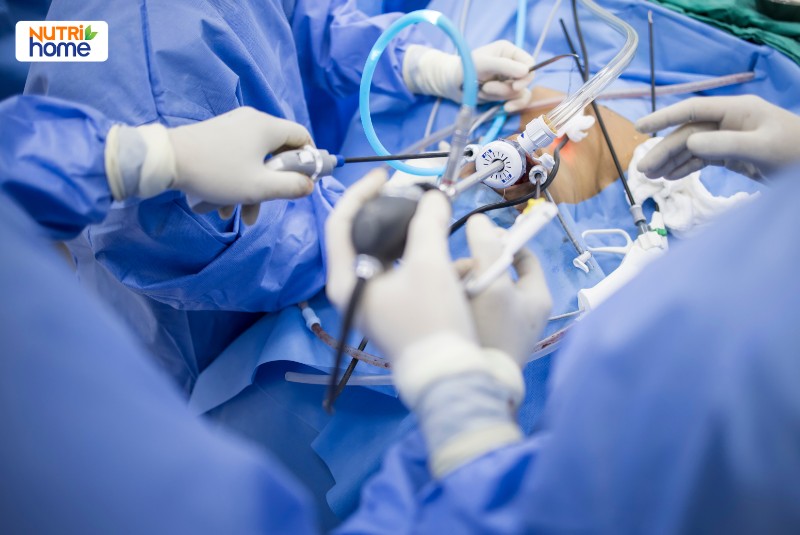 Bác sĩ đang thực hiện phẫu thuật nội soi điều trị ung thư cổ tử cung giai đoạn tiến triển