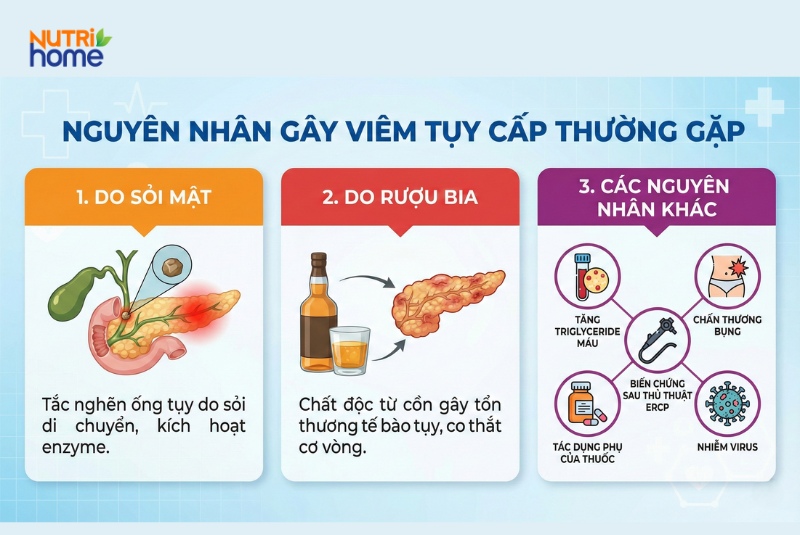 Các nguyên nhân viêm tụy cấp phổ biến gồm sỏi mật, rượu bia và nhiều yếu tố khác