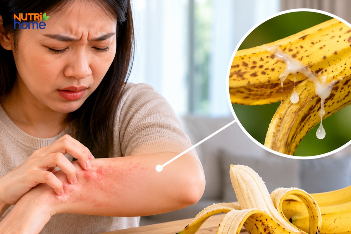 Người phụ nữ gãi vùng da mẩn đỏ do dị ứng chuối, cận cảnh mủ chuối