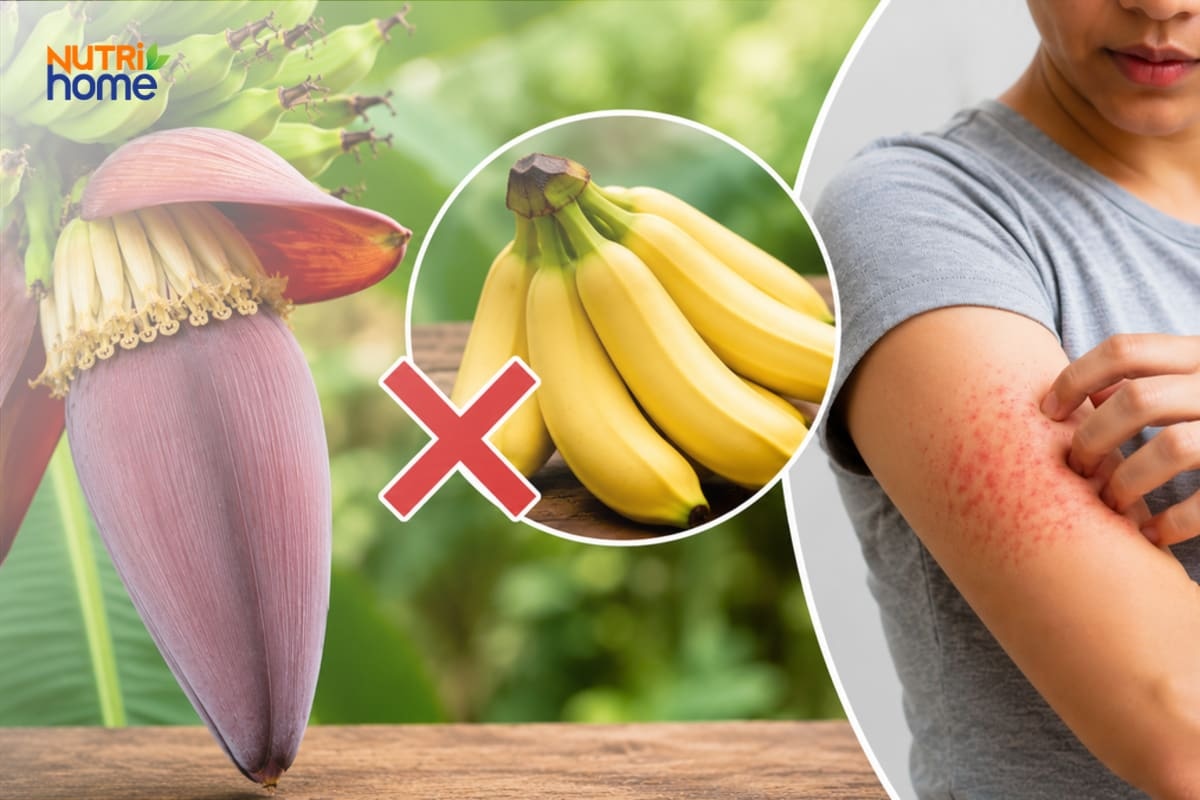Hoa chuối và nguy cơ dị ứng gây mẩn đỏ trên da