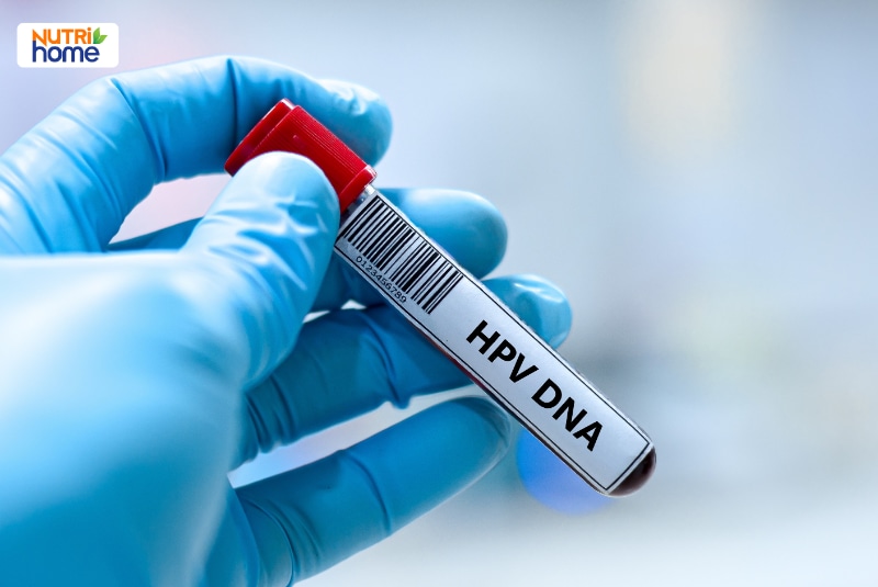Ống bệnh phẩm được ghi nhãn HPV DNA phục vụ xét nghiệm